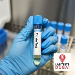 24-Hour Urine Citrate Test for Kidney Stone Prevention