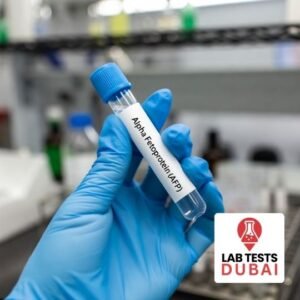 Alpha Fetoprotein (AFP) Test