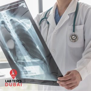 Angle X-Ray Imaging