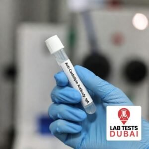 Anti-Cardiolipin Antibody IgA Test