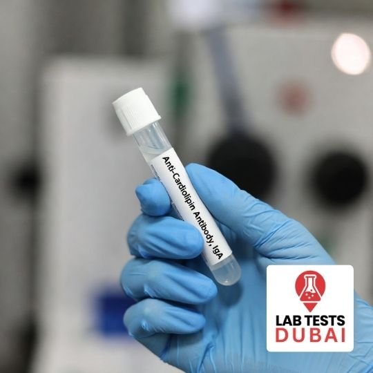 Anti-Cardiolipin Antibody IgA Test – Accurate Autoimmune Blood Testing 1 Anti-Cardiolipin Antibody IgA Test