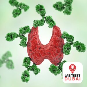Anti-Cardiolipin IgG