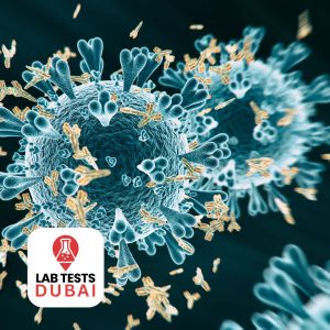 Anti-Infliximab Antibodies Test