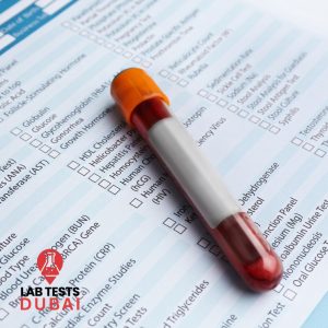 Accurate Anti-Rabies Antibodies Test, Fast & Reliable Rabies Immunity Check