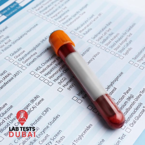 Accurate Anti-Rabies Antibodies Test, Fast & Reliable Rabies Immunity Check