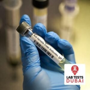 Anti-Varicella Zoster Antibodies, IgM