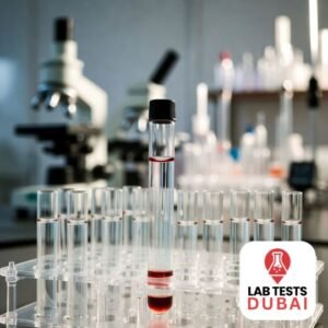 Antistreptolysin “O” (ASO) – Titre Test