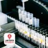 C13 Urea Breath Test