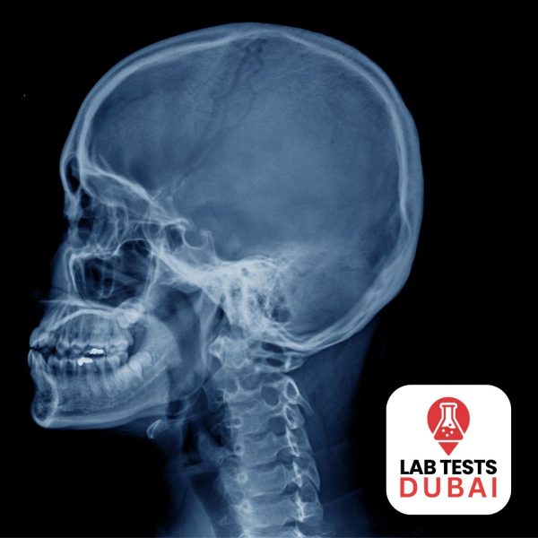 Cephalometric X-Ray & OPG