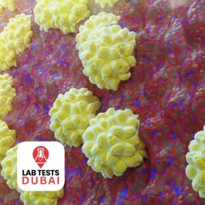 Chlamydia Trachomatis IgA