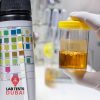 Essential Elements Urine Test