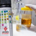 Essential Elements Urine Test