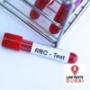 Folate (RBC) Test