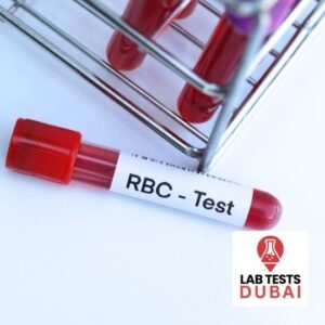 Folate (RBC) Test