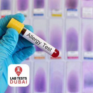 Food Allergy Test Dubai
