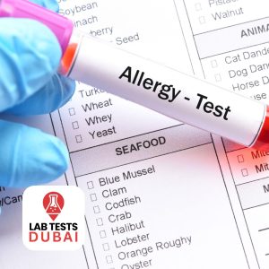 Food Allergy Test in Dubai