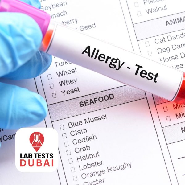 Food Allergy Test in Dubai