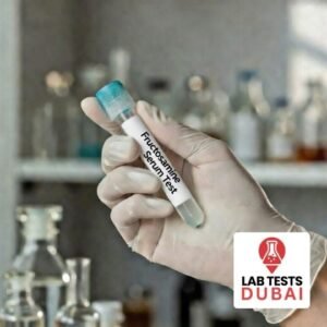 Fructosamine Serum Test