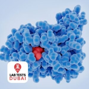 HER-2NEU - FISH Test