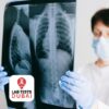HRCT Chest Studies