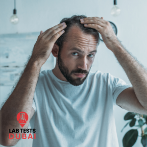 Hair Loss Test