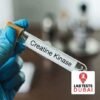 All Lab Tests Services 17 High-Precision Creatine Kinase (CK) Isoenzymes Electrophoresis Serum Analysis