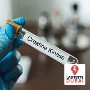 High-Precision Creatine Kinase (CK) Isoenzymes Electrophoresis Serum Analysis