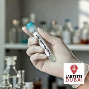 JAK2 Gene Mutation Test