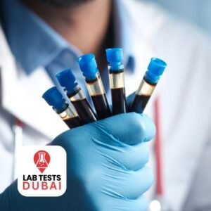 KRAS mutation analysis