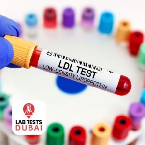 LDL 7 Class Subfractions Test