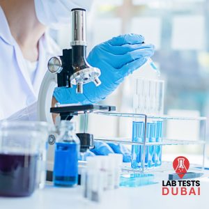 24-Hour Urine Citrate Test for Kidney Stone Prevention | Accurate Spectrophotometry Analysis for Optimal Kidney Health