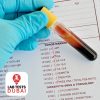 17 Hydroxycorticosteroids
