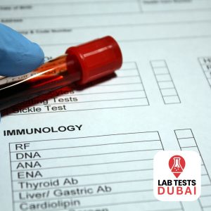 Anti-DNA Antibodies (ds-DNA Abs)
