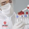 Zika Virus Serology