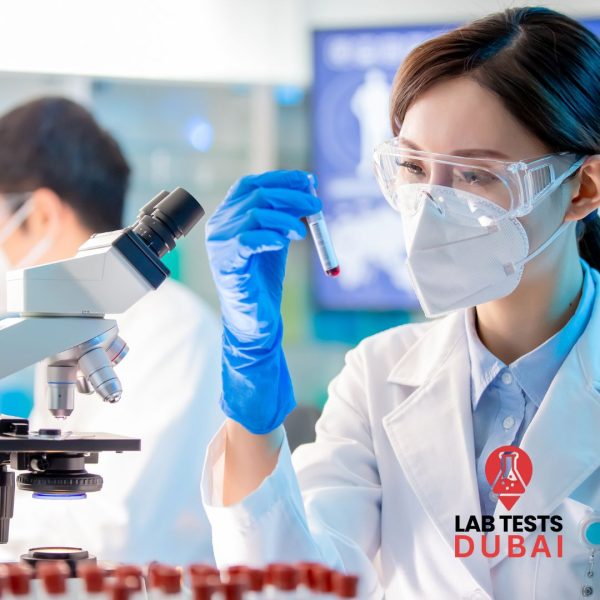 ZNS for Acid Fast Bacilli (AFB)