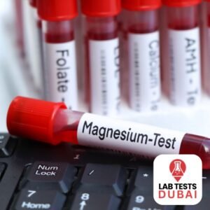 Magnesium test (24 Hour Urine)