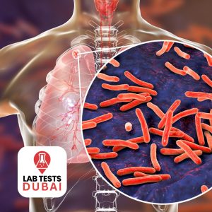 Mycobacterium Tuberculosis PCR Test
