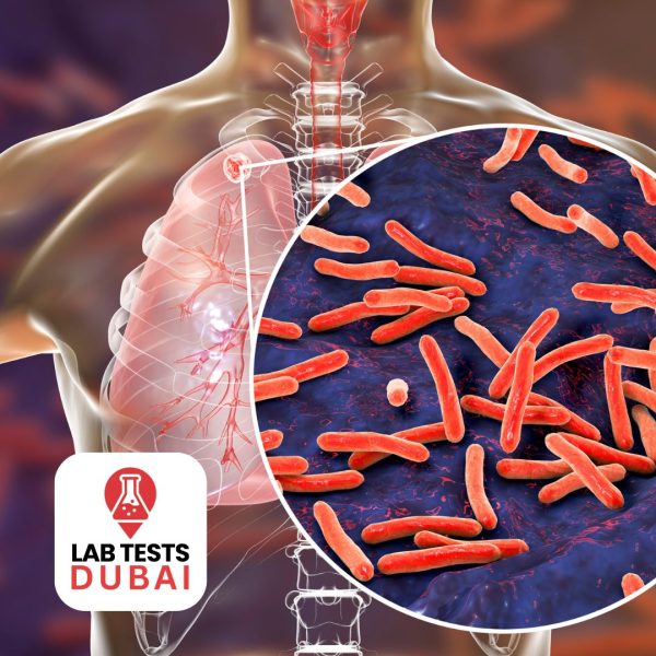 Mycobacterium Tuberculosis PCR Test