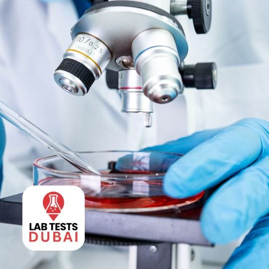 PCR FOR HLA B27 (EDTA)