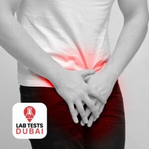 Prostatic Specific Antigen