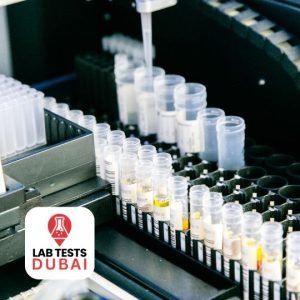 Protein Immunoelectrophoresis Test