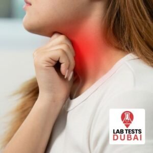 Rapid Streptococcus A Test