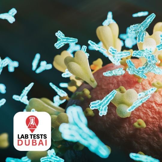 Rubella Antibodies, IgG + IgM--(Rubella IgG & IgM Antibodies) 1 Rubella Antibodies