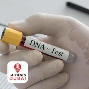 SCA-8 Genetic Test