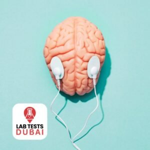 Spino Cerebellar Ataxia