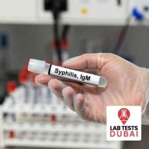 Syphilis, IgM test