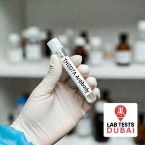 THSD7A Antibody (IFT) Lab Test