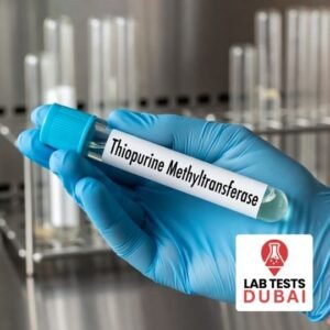 Thiopurine Methyltransferase TPMT