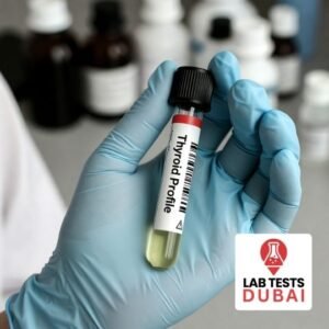 Thyroid Profile I (TSH, Free T3, Free T4)