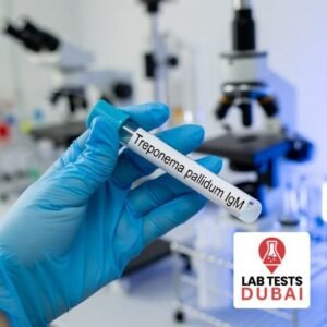 Treponema pallidum IgM Test